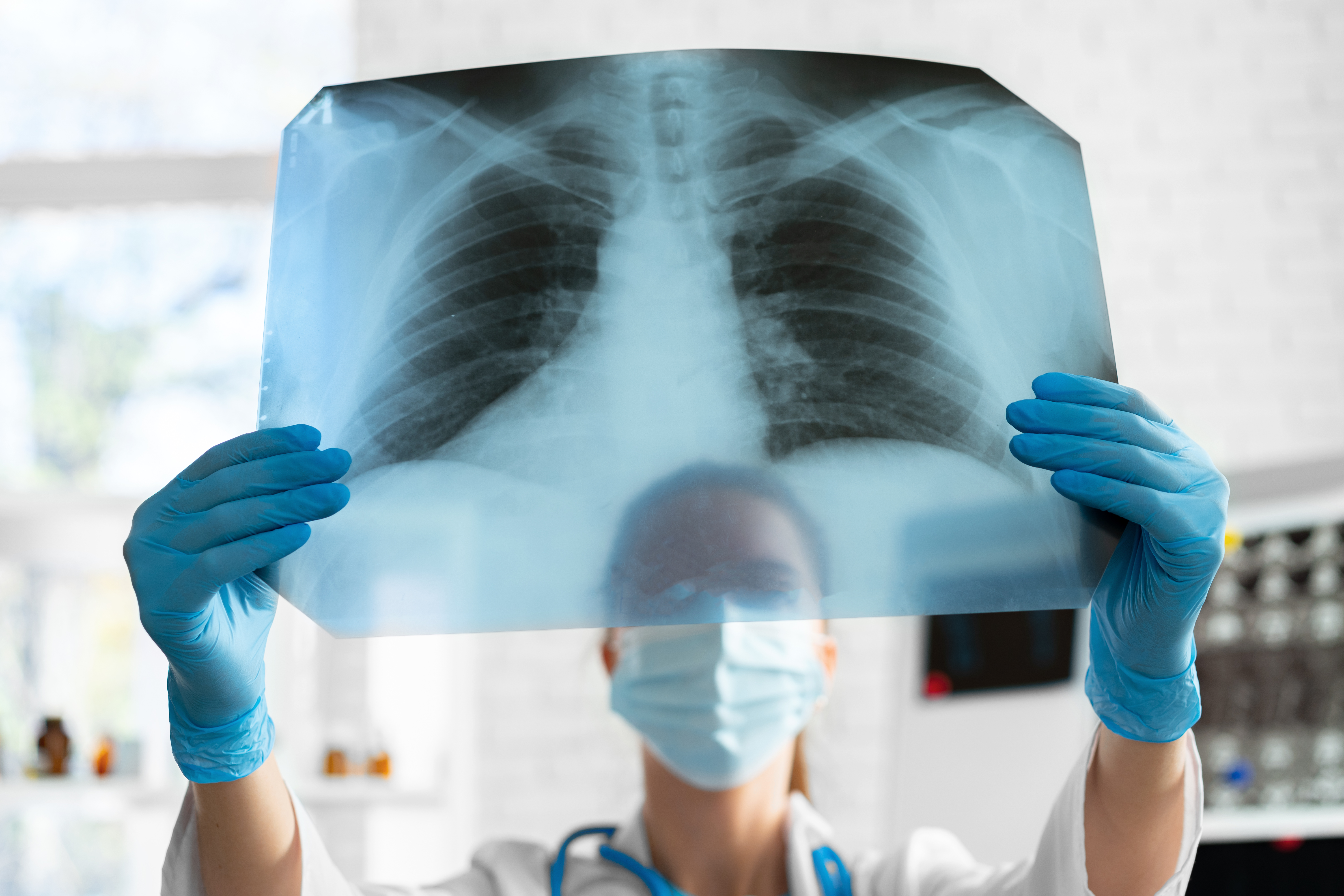 Läkare tittar på röntgenplåt. Foto: MostPhotos